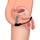 Cross-section of male anatomy with 10x Inflatable Vibrating Prostate Plug and Cock Ring